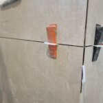 totalna rekonstrukcija keramika